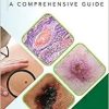Skin Cancer: A Comprehensive Guide (Original PDF from Publisher)