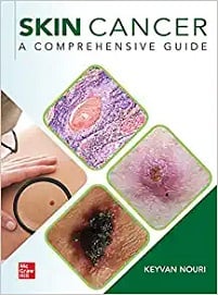 Skin Cancer: A Comprehensive Guide (Original PDF from Publisher)