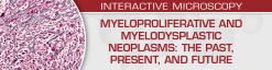 Myeloproliferative and Myelodysplastic Neoplasms: The Past, Present, and Future – USCAP (Videos)