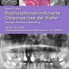 Bisphosphonat-induzierte Osteonekrose der Kiefer: Ätiologie, Prävention, Behandlung (German Edition) (EPUB)