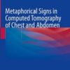 Metaphorical Signs in Computed Tomography of Chest and Abdomen, 2nd Edition (Original PDF from Publisher)