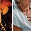 Harvard Diabetes Comorbidities and Complications 2024 (Videos with captions + Slides)