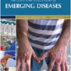 The Gale Encyclopedia of Emerging Diseases, 2nd Edition (EPUB)