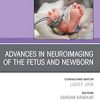 Advances in Neuroimaging of the Fetus and Newborn, An Issue of Clinics in Perinatology (Volume 49-3) (The Clinics: Internal Medicine, Volume 49-3) (Original PDF from Publisher)
