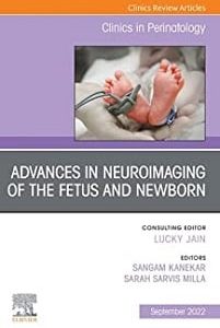Advances in Neuroimaging of the Fetus and Newborn, An Issue of Clinics in Perinatology (Volume 49-3) (The Clinics: Internal Medicine, Volume 49-3) (Original PDF from Publisher)