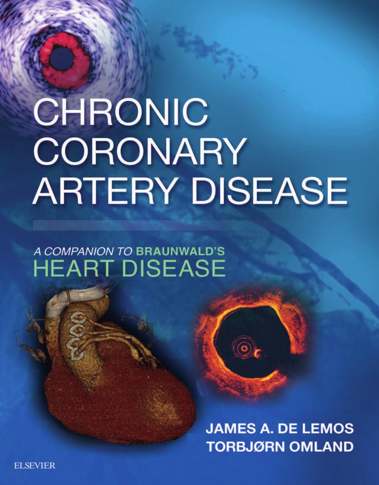 Chronic Coronary Artery Disease: A Companion to Braunwald’s Heart Disease E-Book 1st Edition (PDF)