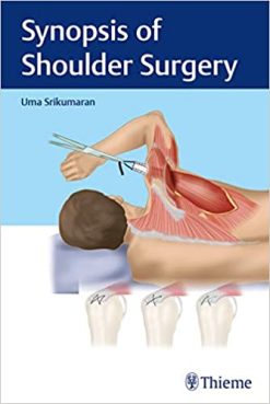 Synopsis of Shoulder Surgery (Original PDF from Publisher)