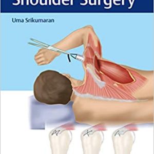 Synopsis of Shoulder Surgery (Original PDF from Publisher)