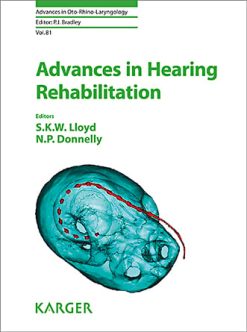Advances in Hearing Rehabilitation (Advances in Oto-Rhino-Laryngology, Vol. 81) (PDF)