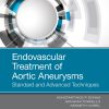 Endovascular Treatment of Aortic Aneurysms: Standard and Advanced Techniques, 1st Edition (PDF)