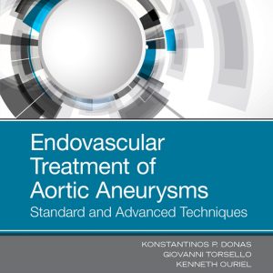 Endovascular Treatment of Aortic Aneurysms: Standard and Advanced Techniques, 1st Edition (PDF)
