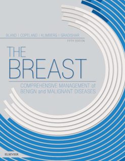 The Breast E-Book: Comprehensive Management of Benign and Malignant Diseases, 5ed (PDF)