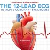 The 12-Lead ECG in Acute Coronary Syndromes, 4th Edition (PDF)