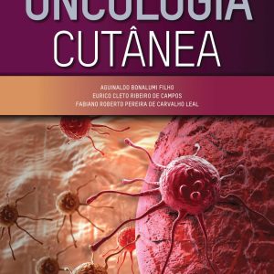 Oncologia Cutânea (Portuguese Brazilian) (PDF)