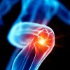 Mayo Clinic Comprehensive Sports Medicine Update and Board Review 2021 (Videos)