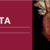 2018 Classic Lectures in Cardiac CTA (Videos)