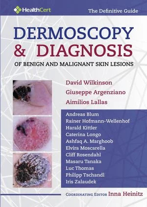 Dermoscopy and Diagnosis of Benign and Malignant Skin Lesions (ePub)