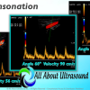 Mastering Doppler Principles and Hemodynamics- AllAboutUltrasound (Complete HTML)