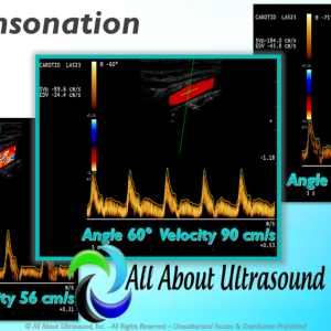 Mastering Doppler Principles and Hemodynamics- AllAboutUltrasound (Complete HTML)