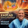 OHI-S EXOCAD Implant Restorations – Step-by-step Video Guide 2023 (Videos)
