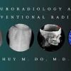 Neuroradiology and Interventional Radiology 2020 (Videos)