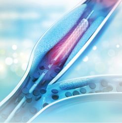 Comprehensive Review and Update of What’s New in Vascular and Endovascular Surgery 2023 (Videos)