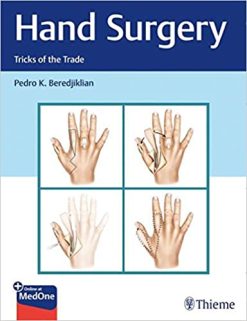 Hand Surgery: Tricks of the Trade, 1st Edition (Original PDF from Publisher)