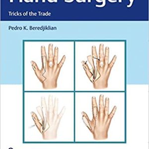 Hand Surgery: Tricks of the Trade, 1st Edition (Original PDF from Publisher)