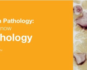 Classic Lectures in Pathology: What You Need to Know: Hematopathology 2019 (Videos)