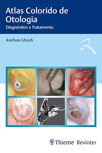 Atlas Colorido de Otologia: Diagnóstico e Tratamento (Portuguese Edition) (EPUB)