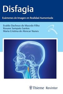 Disfagia: Exámenes de Imagen en Realidad Aumentada (Spanish Edition) (EPUB)
