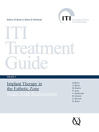 Implant Therapy in the Esthetic Zone: Single-Tooth Replacements (ITI Treatment Guide Series Book 1) (EPUB)