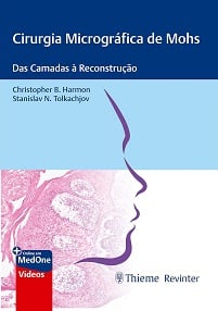 Cirurgia Micrográfica de Mohs: Das Camadas à Reconstrução (Portuguese Edition) (EPUB)