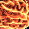 Harvard Neurology for the Non-Neurologist 2023 (Videos)