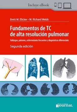 Fundamentos De Tc De Alta Resolucion Pulmonar Hallazgos, 2ª edición (High Quality Image PDF)