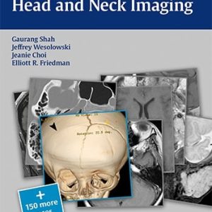 Head and Neck Imaging (RadCases) (Original PDF from Publisher)