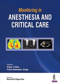 Monitoring in Anesthesia and Critical Care (Original PDF From Publisher)