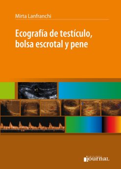 Ecografía de Testículo, Bolsa Escrotal y Pene (High Quality Image PDF)