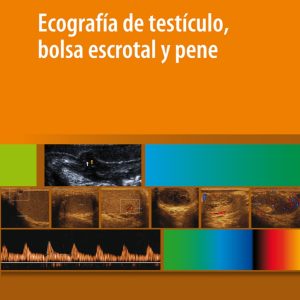 Ecografía de Testículo, Bolsa Escrotal y Pene (High Quality Image PDF)