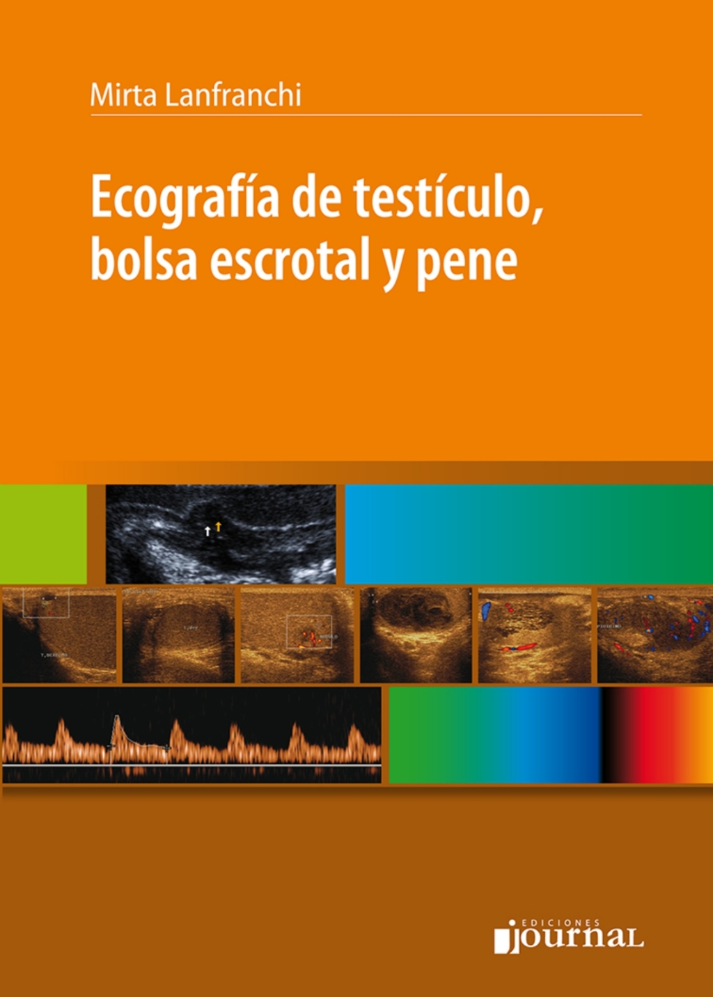 Ecografía de Testículo, Bolsa Escrotal y Pene (High Quality Image PDF)