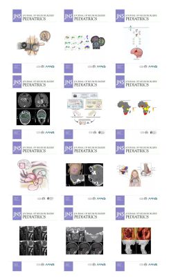 Journal of Neurosurgery: Pediatrics 2024 Full Archives (True PDF)