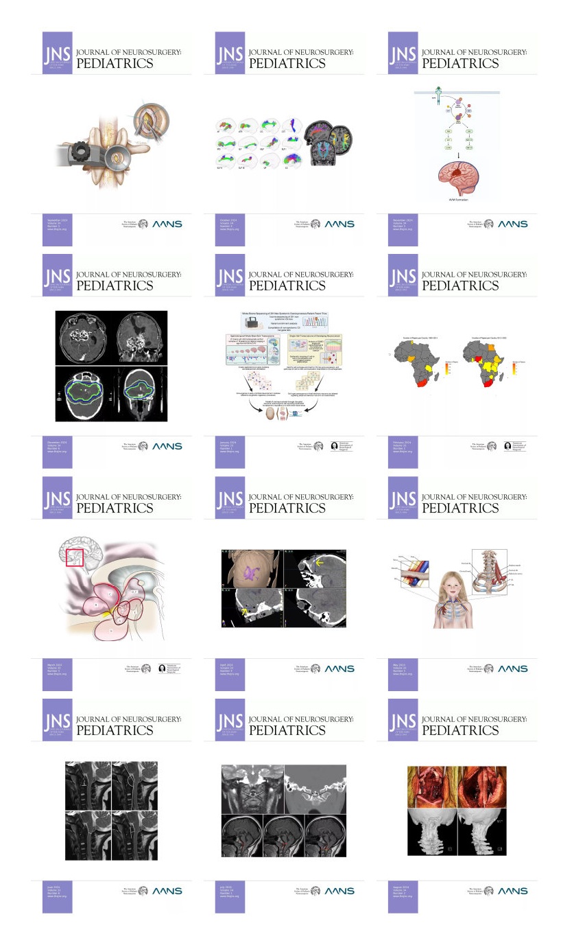 Journal of Neurosurgery: Pediatrics 2024 Full Archives (True PDF)