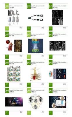 Journal of Neurosurgery: Spine 2023 Full Archives (True PDF)