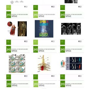 Journal of Neurosurgery: Spine 2023 Full Archives (True PDF)