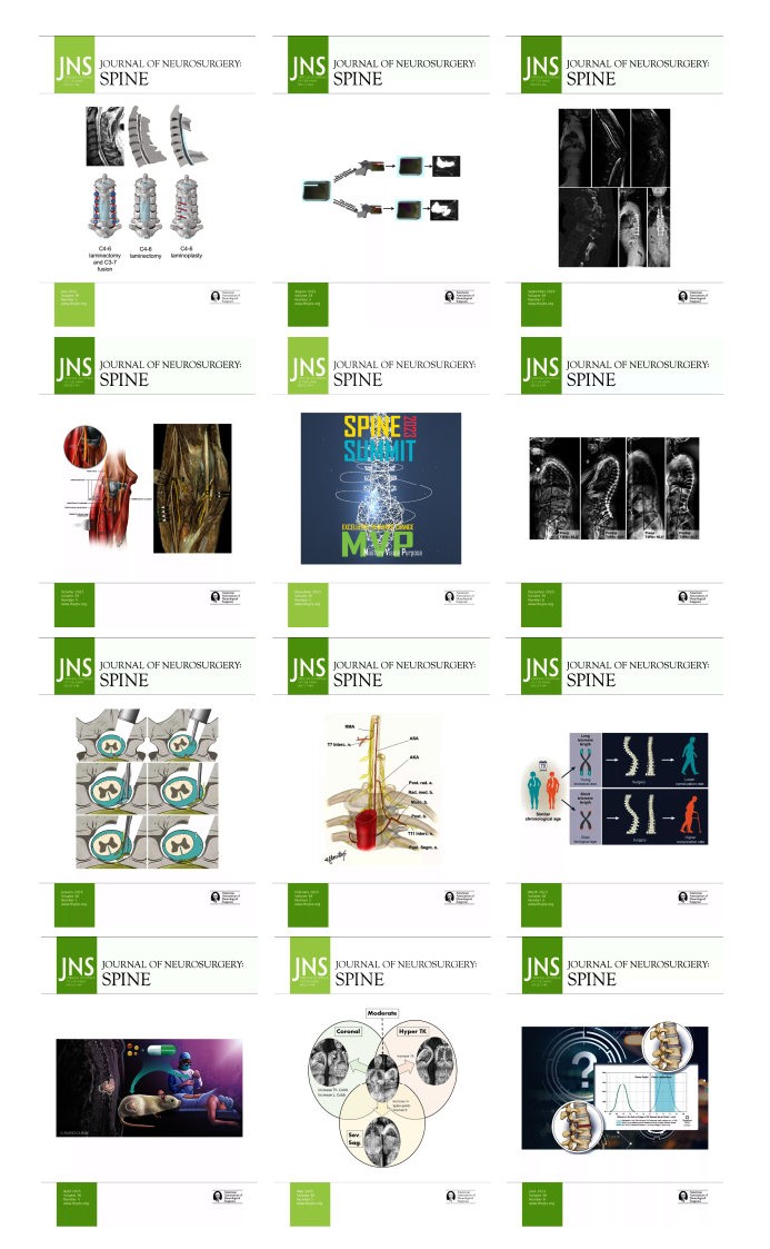 Journal of Neurosurgery: Spine 2023 Full Archives (True PDF)