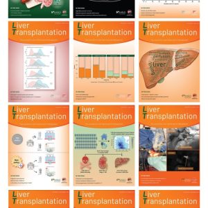 Liver Transplantation 2024 Full Archives (True PDF)