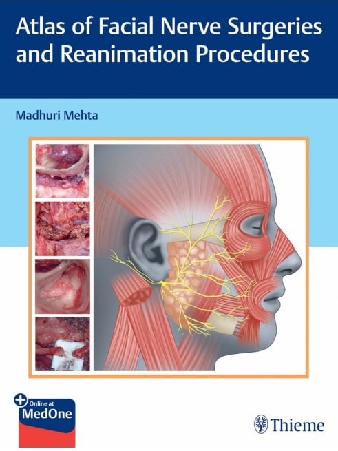 Atlas of Facial Nerve Surgeries and Reanimation Procedures (Original PDF from Publisher)