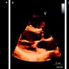 Mayo Clinic Echocardiography Board Review 2019 (Videos)