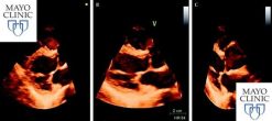 Mayo Clinic Echocardiography Board Review 2019 (Videos)