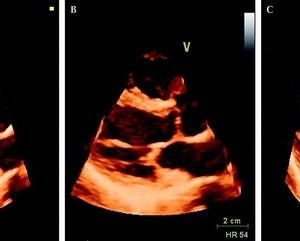 Mayo Clinic Echocardiography Board Review 2019 (Videos)